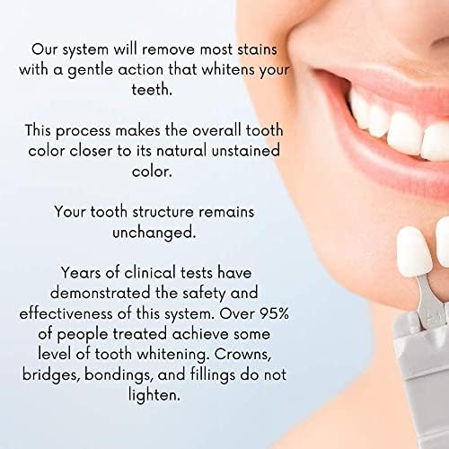 Bijeli zubi Global 10 šprica Novi najjači 44% karbamid peroksidni gel za izbjeljivanje zuba